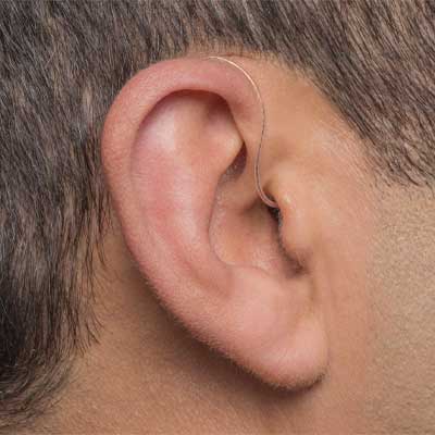 Behind-the-Ear (BTE) and Receiver-in-the-Ear (RIC) Hearing Aids.